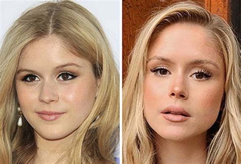 Erin Moriarty plastic surgery journey and。